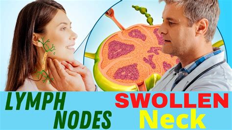 Swelling of the eyes, face, lips, neck, or area below the chin. . How to flush lymph nodes in neck